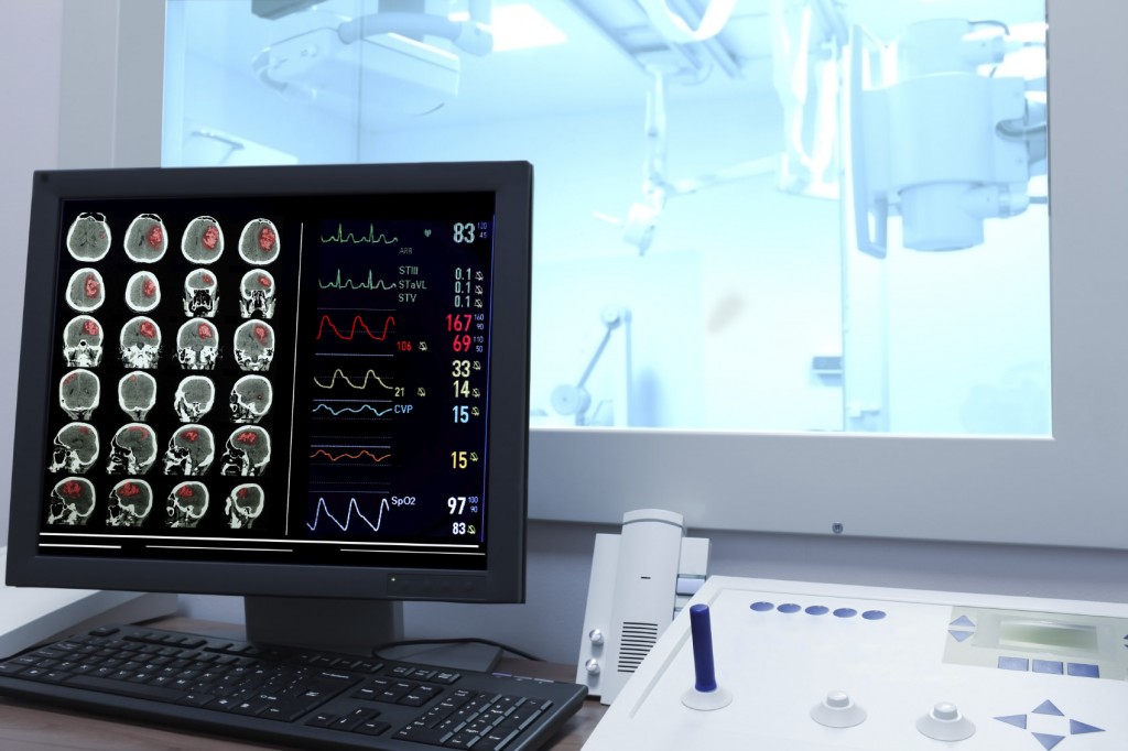 Traumatic Brain Injury patient's MRI scan