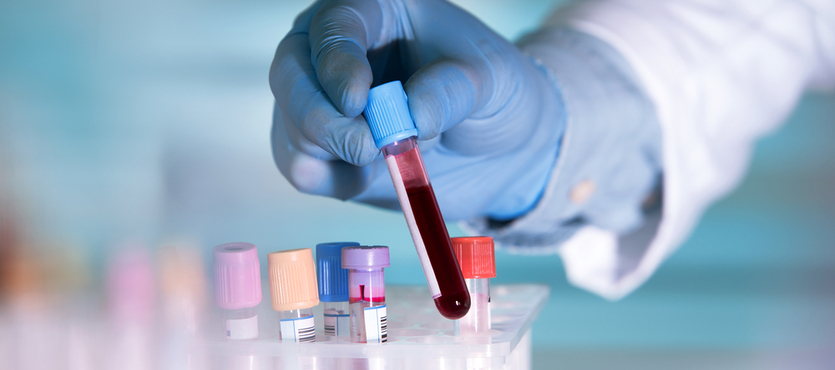 FDA Okays Brain Injury Blood Test